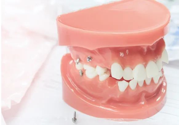 治療の精度が高い