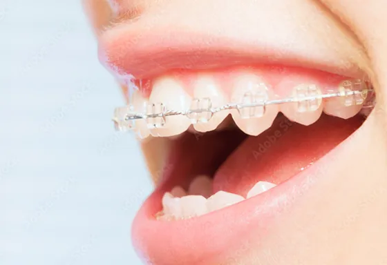 目立ちにくい装置も選べる