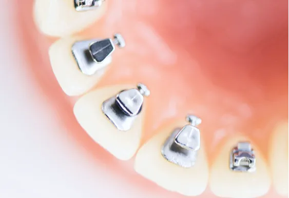 装置は徐々に付けていく